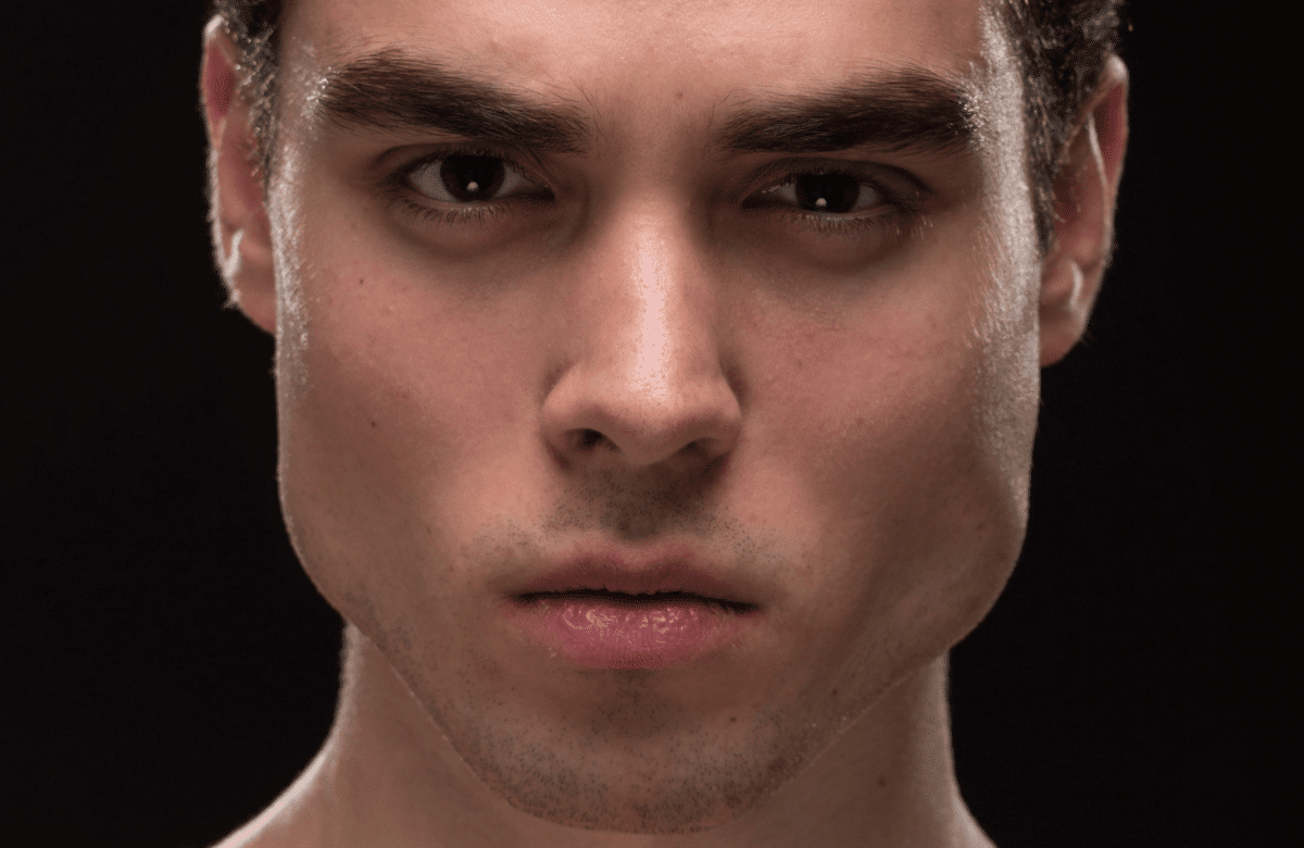 Traitement FUE pour lutter contre la calvitie à Aubagne