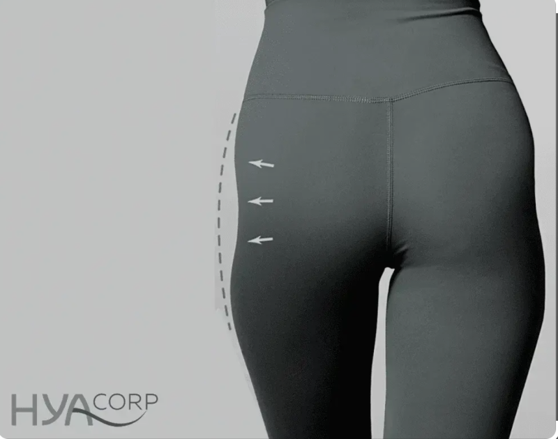 Injection d'acide Hyaluronique Hyacorp pour traiter HIP DIPS à Marseille