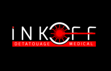 Centre de détatouage Marseille Inkoff
