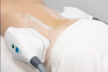 Notre zone d'activité pour ce service Prix pour une greffe de cheveux à